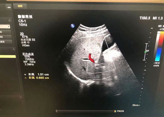 Philip C5-1 sonda de ultrassom médico abdominal para dispositivo EPIQ 5
