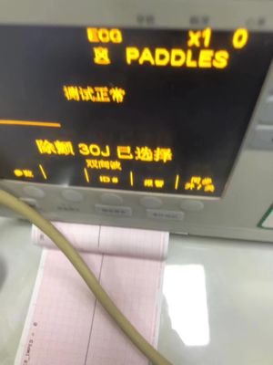 ZOLL Série M Defibrilador Partes de Máquina Faculdade Serviço de Reparação Venda a retalho