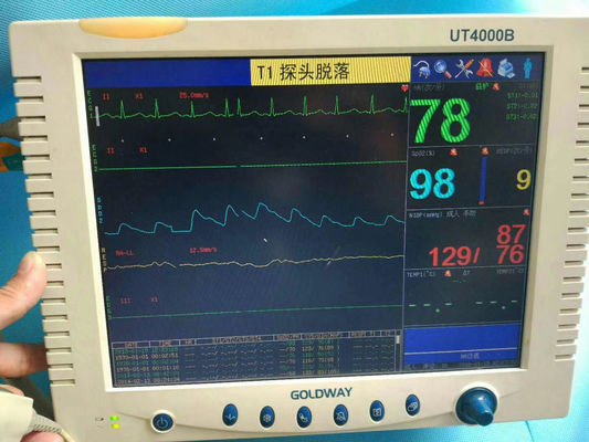 Goldway UT4000B Monitor do Paciente Reparação Monitor do Paciente Médico Manutenção